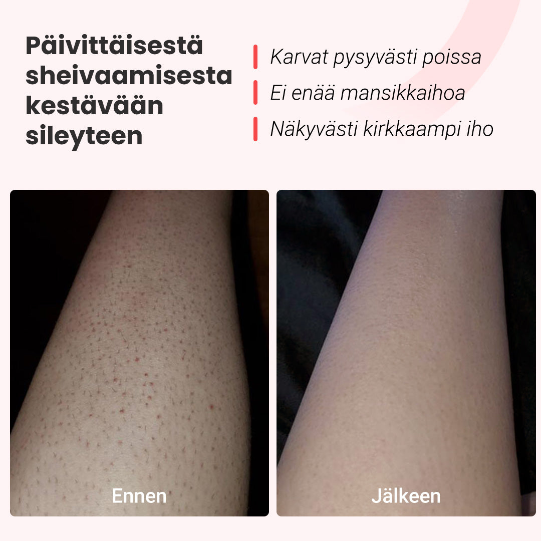 IPL -valoepilaattori