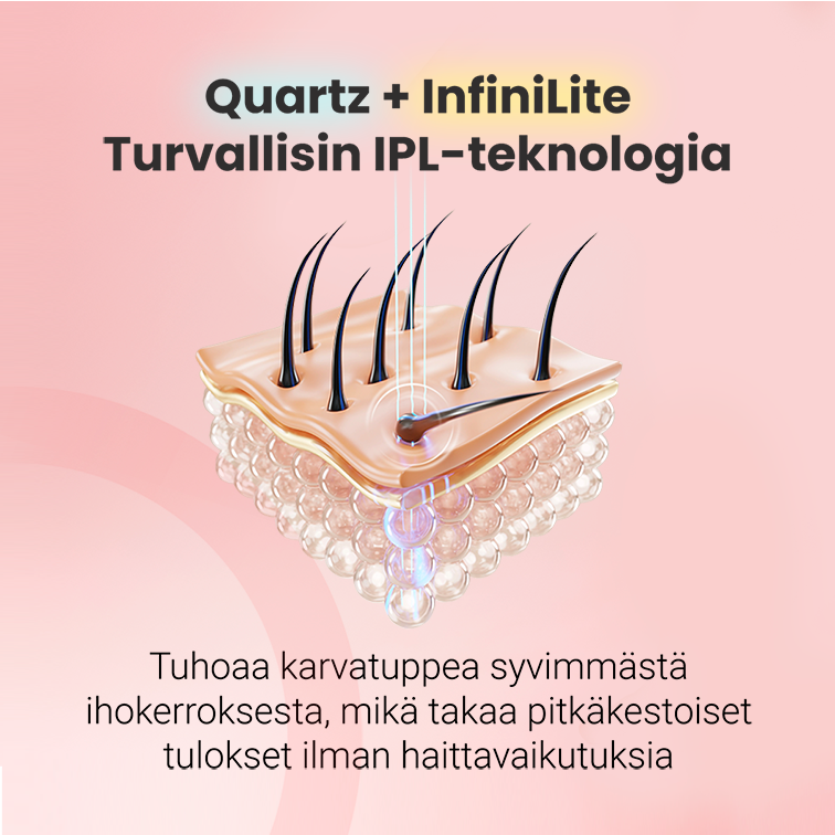 IPL -valoepilaattori