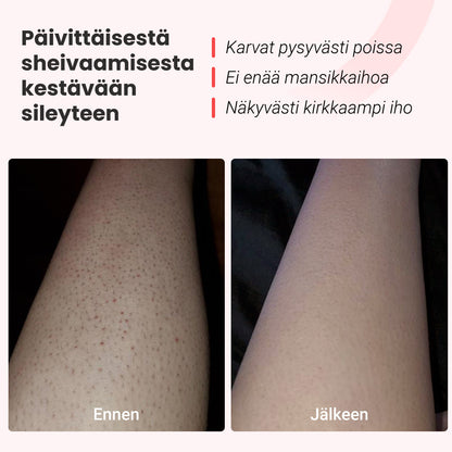 IPL -valoepilaattori